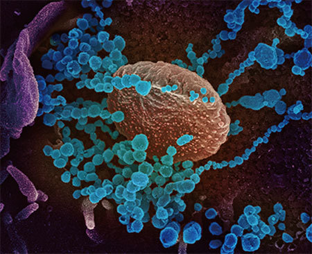 專家分析,COVID-19病毒很有可能是按照納米機器人殺手的標準製作的人工病毒。圖為中共病毒在電子顯微鏡下的圖像。(AFP)。